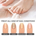 thumbnail image 3 of Lápiz para El Cuidado de Las Uñas | Solución para Uñas de Los Pies | Lápiz para Engrosar y Reparar Uñas | Abrillantador de Uñas | Cuidado de Uñas Granuladas (3 Ml) | Fortalece Las Uñas | Compuesto de, 3 of 7