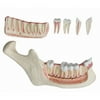 Walter Products Lower Jaw Model