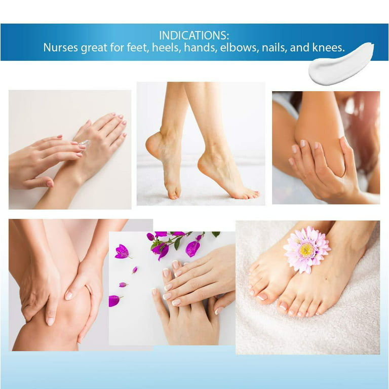 Urea 40% Foot Cream, Allantoin Foot Cream, Corn, Callus And Dead Skin  Remover Allantoin 40% Cream - Moisturizer & Rehydrater For Feet