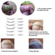 thumbnail image 5 of 12 Unids / Box Incrustación Corrector de Fijación de uñas de los pies 6 Tamaños Ingrown Toe Corre Irfora Herramienta de uñas, 5 of 7