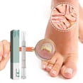 thumbnail image 4 of Fiudx Líquido Reparador de Uñas, Tratamiento Fortalecedor para Uñas Agrietadas, Fórmula Natural de Aloe para Hidratación, Fácil Aplicación para Uso Diario, Solución para El Cuidado de Uñas Saludables, 4 of 6