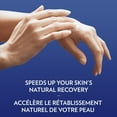 thumbnail image 3 of Vaseline Original Healing Travel Petroleum Jelly, 3 of 8