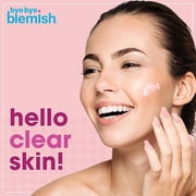 Bye Bye Blemish Acne Drying Lotion with Salicylic Acid for Pimple Care, 1 fl oz