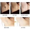 thumbnail image 5 of Suero de inhibición permanente del cabello, eliminador de vello indoloro, axila, piernas, brazos, inhibidor de crecimiento del cabello, cuidado depilatorio, 5 of 5