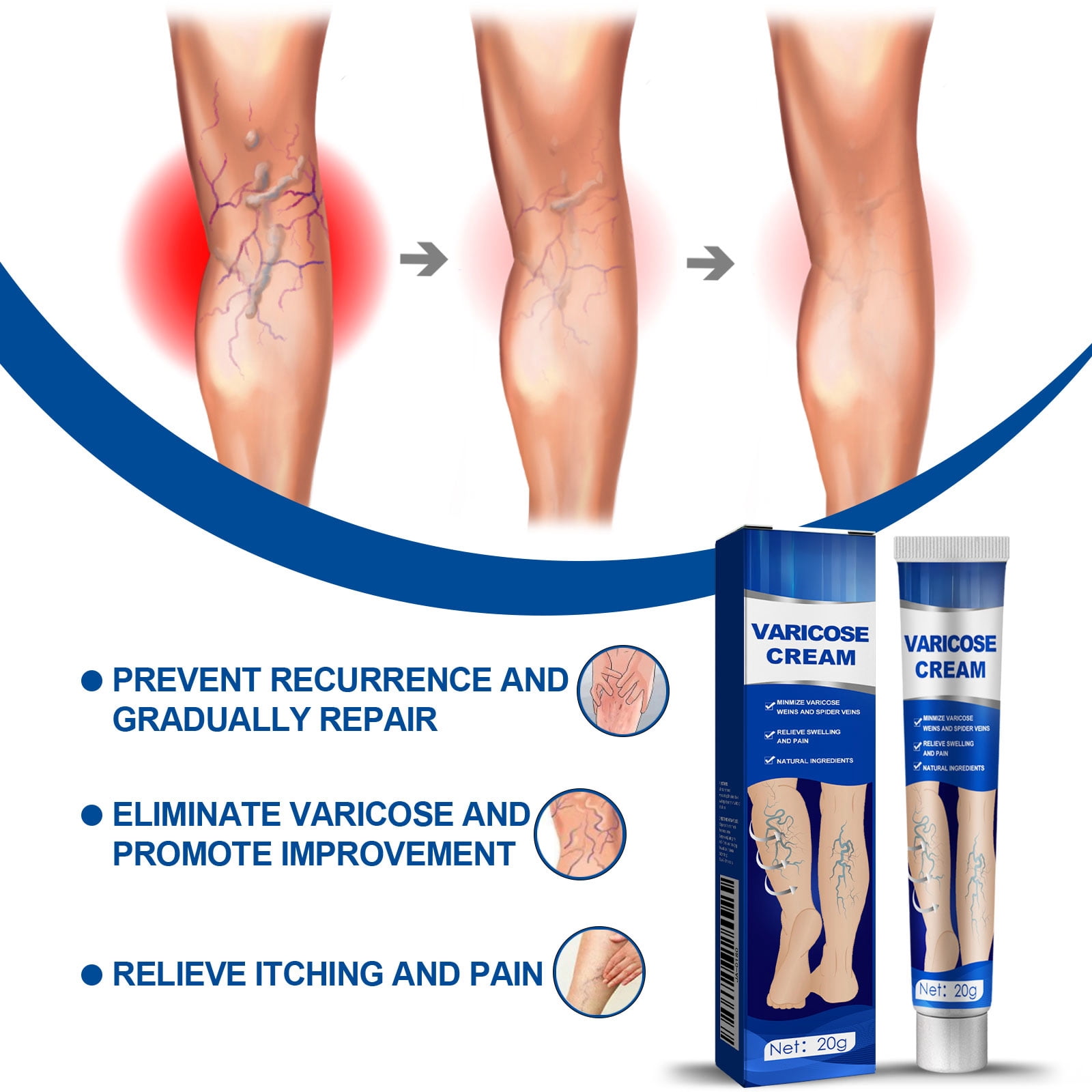 Alvantor Leg & Foot Varicose Cream, 0.7oz, Moisturizes & Relieves Discomfort, 0.7oz