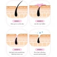 thumbnail image 5 of Hopy Hair Removal Cream- Aloe Vera, Vitamin E, and Olive Oil - Intimate - Body Legs Arms Underarms - Skin Friendly - 50g, 5 of 5