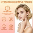 thumbnail image 6 of Pimple Patches for Face, Hydrocolloid Acne Patches, Cute Star Zit Covers, Colorful Superstar Patches Spot Stickers, 102 Count | 4 Sizes (8mm/9mm/11mm/14mm), 6 of 7
