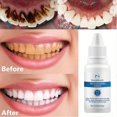 thumbnail image 1 of 10ML Teeth Whitening Essence Removes Plaque Stains Tooth Bleaching Cleaning Serum White Teeth Oral Hygiene, 1 of 4