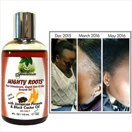 Edge Growth & Thin Hair Serum with Organic Jamaican Pimento & Black Castor Oil/Satin