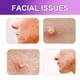 thumbnail image 5 of Parches para el acné en la cara Parche para el acné para aclarar el acné y los granos faciales, cerrar la boca, equilibrar la piel y cuidar los poros delicados, 5 of 9