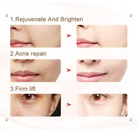 7in1rf Ems Radio Mesotherapy Electroporation Rf Lifting Beauty Led Photon Face Skin Rejuvenation Remover Wrinkle Radio Frequency Walmart Canada