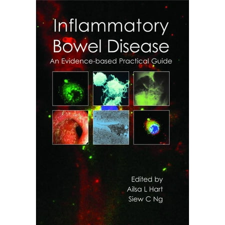 UPC: 9781903378823 | Inflammatory Bowel Disease : An Evidence-Based Practical Guide (Paperback)