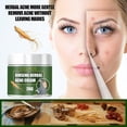 thumbnail image 1 of Crema para el acné HUOGUO Ginseng Herbal Desalt, reparadora de cicatrices, 10-50 g, 1 of 4