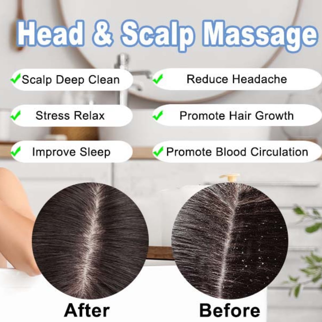 KAMUGO Scalp Massager Portable Electric Scalp Massager Hair Growth,Waterproof Handheld Head Scratcher Massager,3 Speed Modes with 8 Massage Claws Cat Massager(Purple)