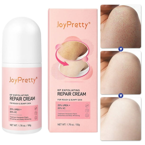 Cremas y humectantes Crema nutritiva para la piel Crema reparadora de queratosis Loción corporal para piernas Crema nutritiva blanqueadora hidratante 50 g Crema reparadora
