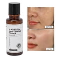thumbnail image 4 of Tóner Blanqueador De Piel ANGGREK 100ml tónico de Arbutina, 4 of 5