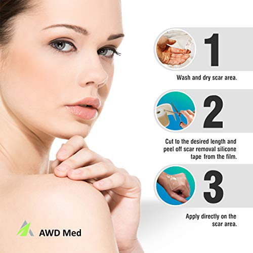 AWD Medical Grade Soft Silicone Gel Tape for Scar Removal Highly... 1.6” x 60” 