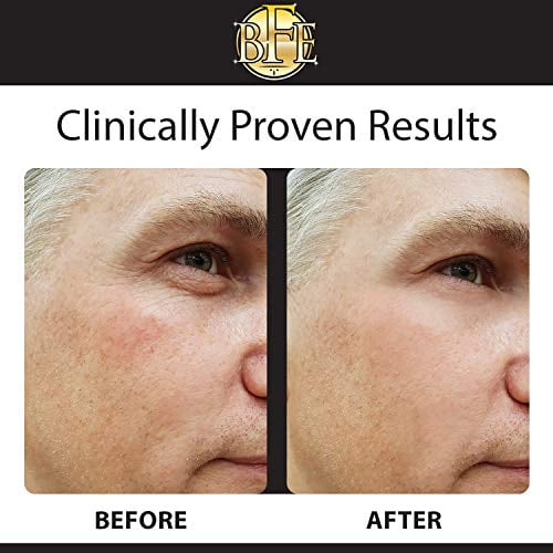 eye cream for sagging under eye