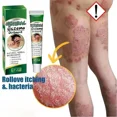 thumbnail image 2 of Crema de hongos para la piel saludable más efectiva, pomada de hierbas naturales, crema antibacteriana para tratar la psoriasis, dermatitis, eczema, 2 of 5