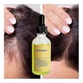 thumbnail image 5 of Aceite para el crecimiento del cabello Aceite para el cabello 100% natural con cafeína, biotina, aceite de ricino, aceite de argán, aceite de coco y aceite de romero Mascarilla espesante eficaz y pérd, 5 of 5