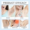 thumbnail image 3 of Razors Bumps Ingrown Hair Treatments Solution, Soothes Hydrates Skin After Shave Cream, for Bikini Line Intimate Area, 3 of 5