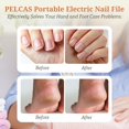 thumbnail image 2 of Molinillo eléctrico de uñas de pies PELCAS AOL10 con kit de manicura y pedicura, 2 of 8