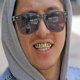 thumbnail image 4 of Dientes de Hip Hop, Joyas de Hip Hop, Dientes Dorados, Brackets y Juego Inferior, Dientes Brillantes, 4 of 6