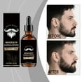 thumbnail image 4 of Beard Care Oil Gentle Daily Care Men's Beard Comfortable Oil 30ml, 4 of 7