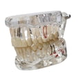 thumbnail image 4 of lionlar Dental Demonstration Teeth Model Observation Practical Removable Study Teach transparent, 4 of 9