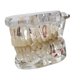 thumbnail image 4 of Demostración dental Modelo de dientes Educación dental Prótesis dental ligera Educar transparente, 4 of 9