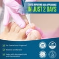 thumbnail image 2 of Bolígrafo para tratamiento de hongos en las uñas de los pies Footcure Extra Strength con 25% de ácido, 2 of 6