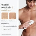 thumbnail image 3 of Braun Silk·expert Pro 5, PL5145 Women & Men’s IPL, At-Home Long Lasting Hair Removal, 3 of 11