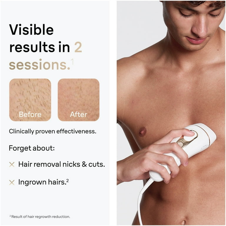 Free Shipping! Braun Silk Expert Pro 5 IPL Hair Removal for Women