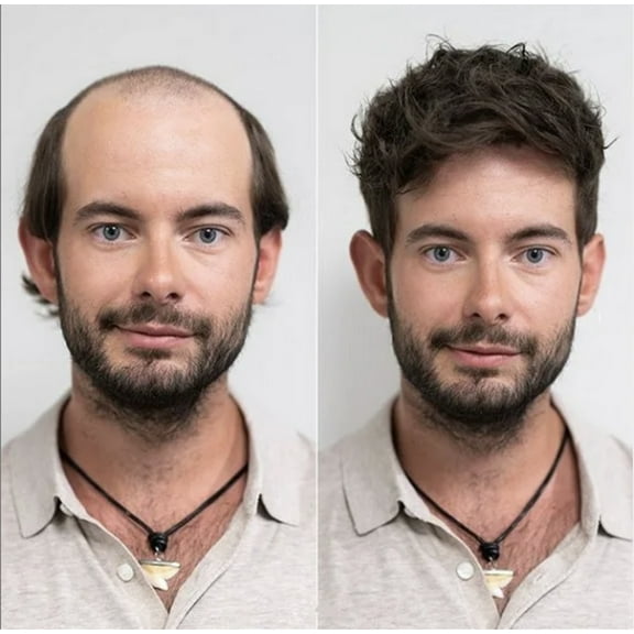 Toupee for Men Hairpiece PU Súper Invisible 0.02 0.03mm Ultra Thin Skin V-looped 100% Human Hair From India with Natural Hairline (8"x10") 1B