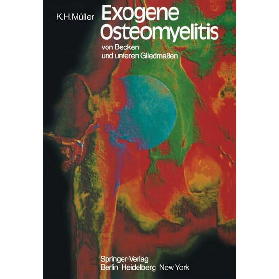 Exogene Osteomyelitis Von Becken Und Unteren GliedmaÃen: Besonderheiten Pathogenese Klinik Therapie Ergebnisse, (Paperback)