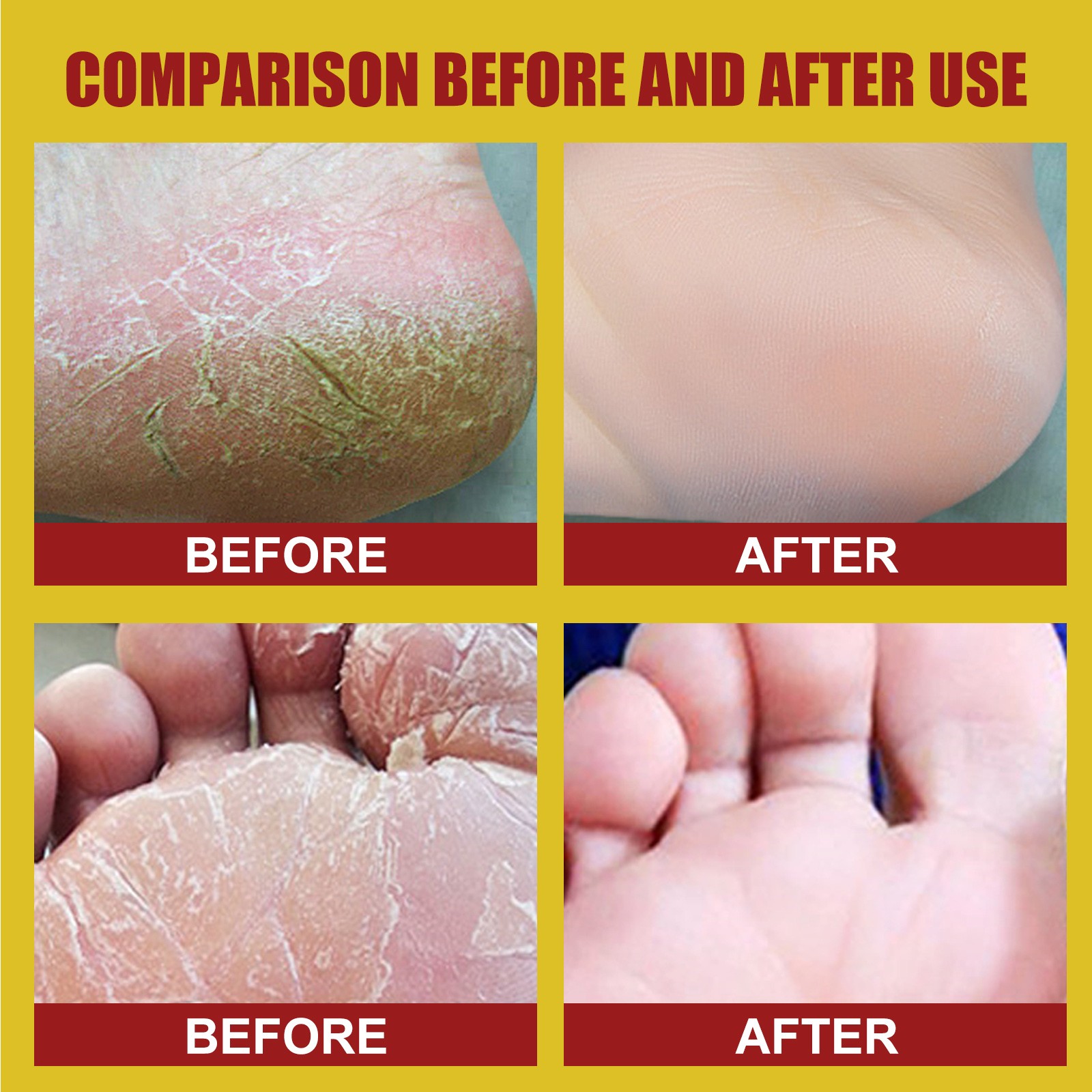 Monfince Foot Cream Horse Oil ,Best Callus Remover for Feet, Knees& Elbows,Natural Moisturizes Nourishes Softens Dry, Rough, Cracked, Dead Skin , 30g