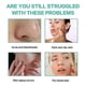 thumbnail image 4 of Hylauronic Acid Cream, Hydrating Face Moisturizer-100% Pure, Undiluted,100g, 4 of 5