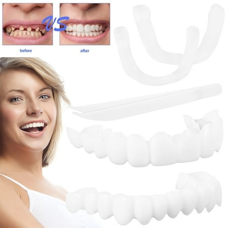 Denture Braces Temporary Veneers Fake Teeth Cover Simulation Braces ...