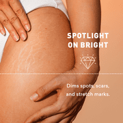 Just Nutritive Even Skin Tone Correcting Treatment, Diminishes Dark Spots, Scars, Stretch Marks, for Balanced, 8oz