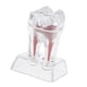 thumbnail image 1 of Seitruly Crystal Base Hard Plastic Tooth Model Molar for Study Teaching Type3 NO3, 1 of 1