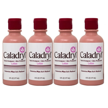 (4 pack) Calamine Lotion by Caladryl, Skin Protectant plus Itch Relief, 6 Fl Oz