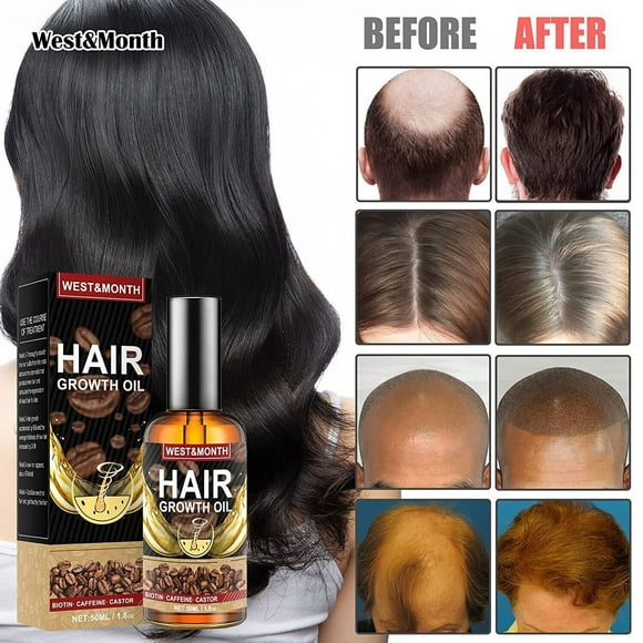 Hair Growth Boosters Hair Growth Boosters