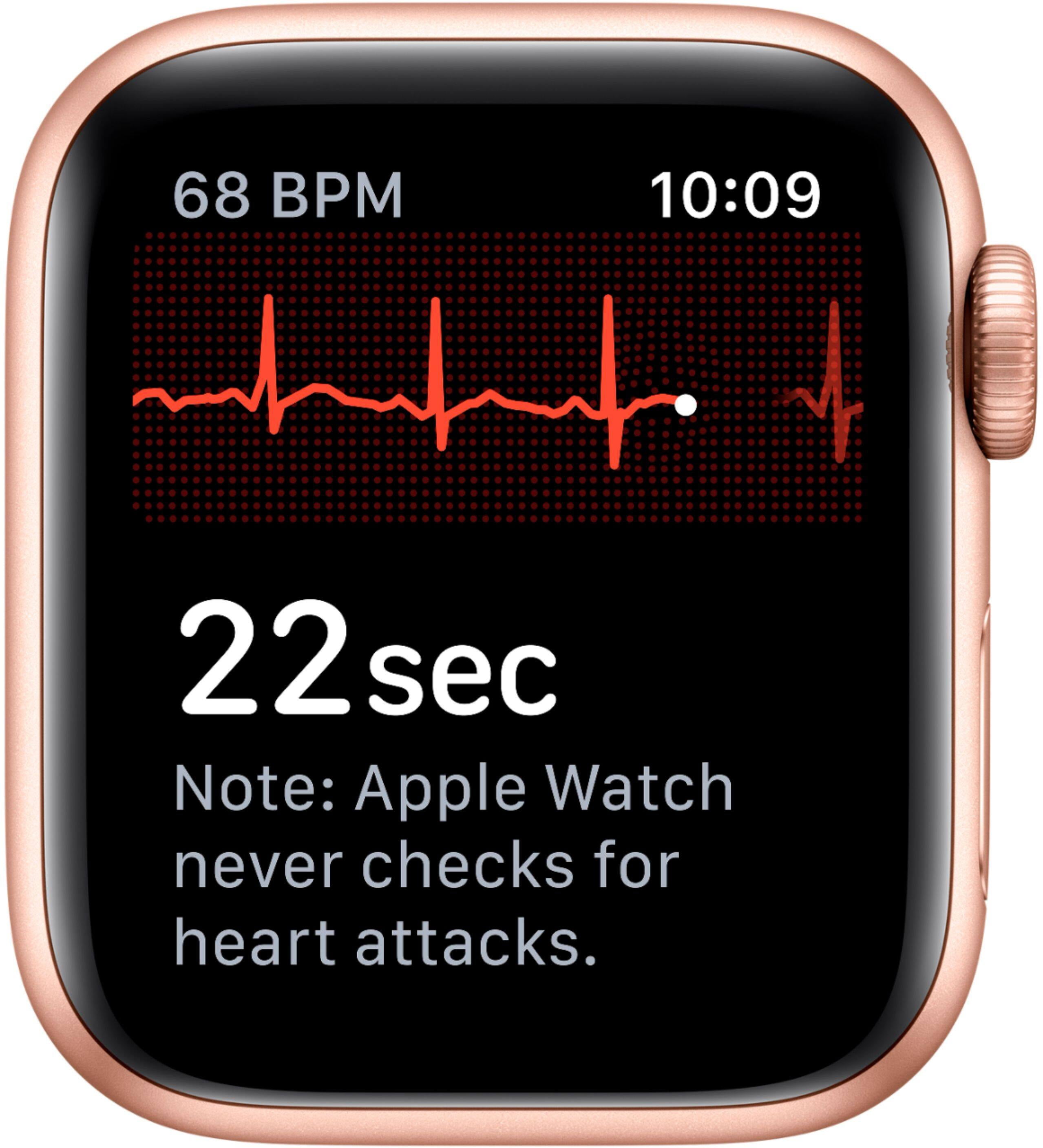 Restored Apple Watch Series 5 (GPS + Cellular) 40mm Smartwatch (Refurbished)