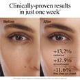 thumbnail image 3 of Sérum facial Neutrogena Rapid Wrinkle Repair Retinol 30 ml, 3 of 9