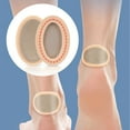 thumbnail image 3 of Almohadilla de cojín de maíz almohadilla de cojín de callos para pies amigable con la piel 5 pares para deportes ANGGREK Otros, 3 of 8