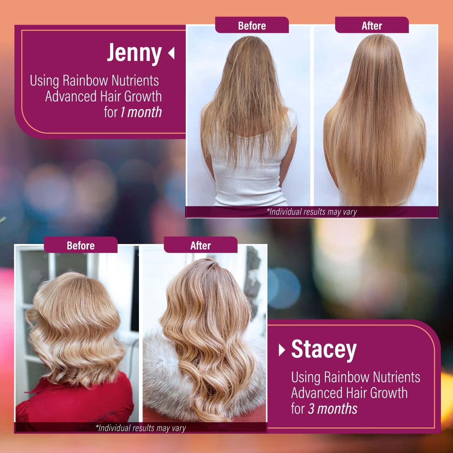 Hair Growth Vitamins for Women , Biotin 10,000mcg, Collagen, Patented OptiMSM , goMCT , Saw Palmetto , Naturally Regrow Stronger & Healthier Hair, Skin and Nails , Stops Hair Loss , 60 Day Supply