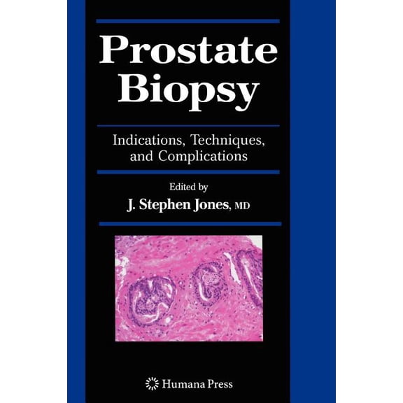 Current Clinical Urology Prostate Biopsy: Indications, Techniques, and Complications, (Paperback)