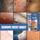 thumbnail image 3 of Crema portátil para el cuidado de la piel del tratamiento de las verrugas del cuerpo del gel de eliminación de manchas instantáneas Tmvgtek cuidado belleza, 3 of 5
