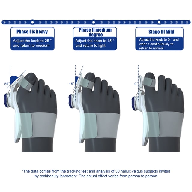 Férula para juanetes Corrector de dedo gordo del pie Perilla ajustable Hallux Valgus (Azul) JShteea Cuidado Belleza