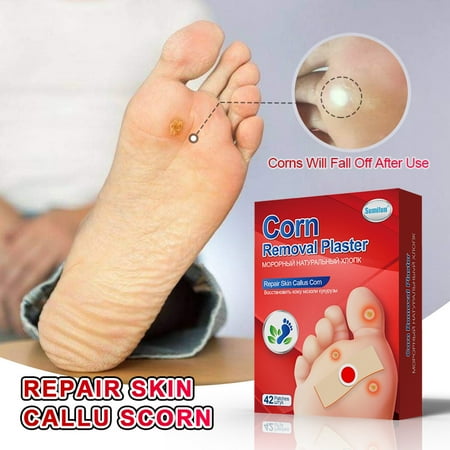 84Pcs/2Boxes Foot Corn Removal Plaster Warts Thorn Feet Callus Remove ...